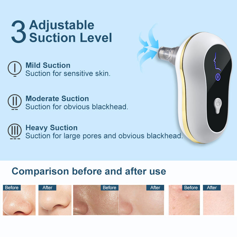 Electric Blackhead Remover Device