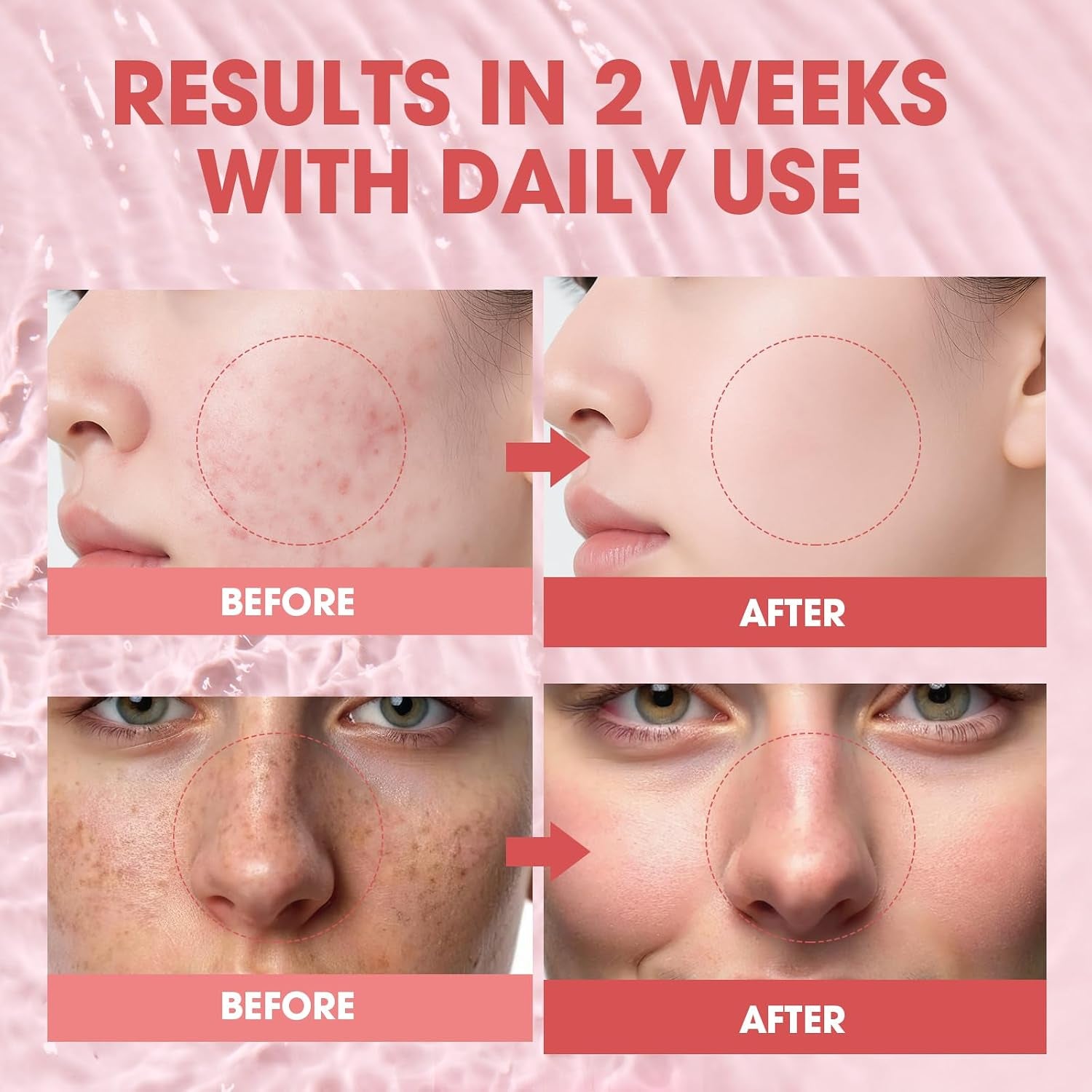 Pink PDRN Salmon DNA Serum – Salmon DNA 10,320Ppm with 12 Peptides & Niacinamide for Skin Repair, Hydration & Firming