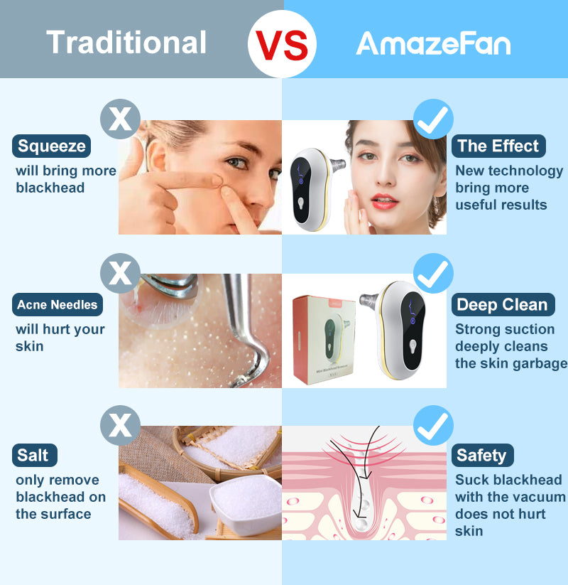 Electric Blackhead Remover Device